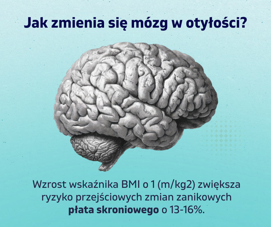 You are currently viewing Jak zmienia się mózg w otyłości?
